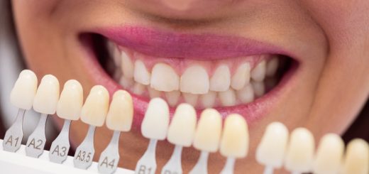dentysta sprawdza pacjentce kolor zębów